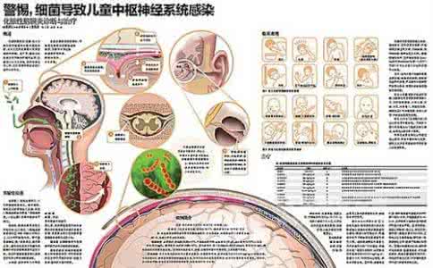 尿道感染发病原因 中枢神经系统感染 它有什么发病原因