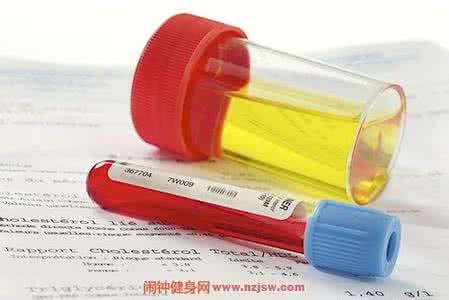 运动性血尿的特点 运动性血尿的原因是什么