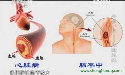 图解：心脏病学专家说 ▎大脑和心脏都喜欢的13个习惯