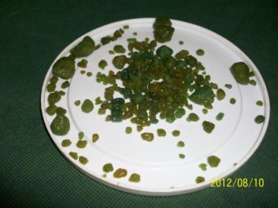 黑绿色大便是在排毒吗 绿色排毒——胆结石（网上资讯）