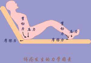 褥疮的原因 褥疮的分期 导致褥疮的原因