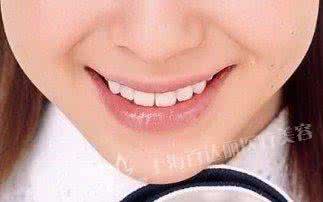 快速美白祛斑的方法 15种快速美白的方法