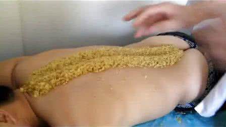 圆式通针疗法视频 圆针疗法视频教程