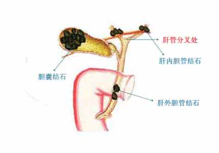 益胆片 益胆片的作用是什么呢