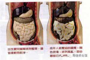 咖啡灌肠 （类）风湿关节炎，试试咖啡灌肠吧！