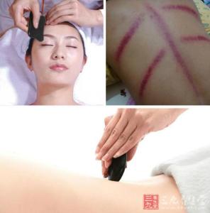 治疗肩周炎最佳方法 肩周炎刮痧治疗