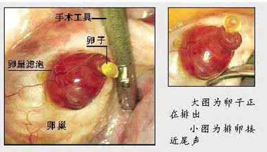 卵泡破裂是不是怀孕 卵泡破裂后能怀孕了吗？