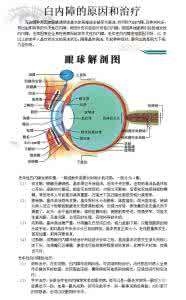 白内障发病率 缺水易患白内障 减缓发病进展勿忘9大措施