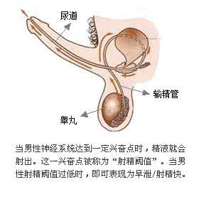 贫血是什么原因造成的 到底造成早泄的原因是什么