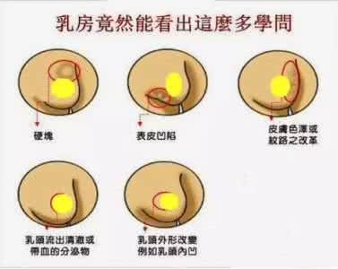 肝癌潜伏期 肝癌潜伏期 拆除潜伏在胸部的“癌炸弹”