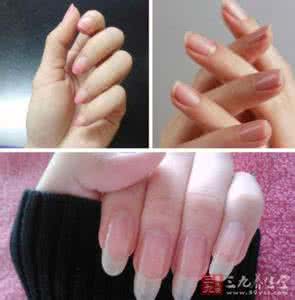 从指甲盖上看健康状况 从指甲盖上看健康状况 指甲上的半月痕 透露健康状况!