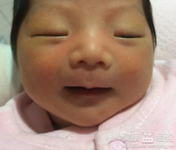 新生儿黄疸不退的原因 新生儿黄疸50天还不退 新生儿黄疸什么原因?