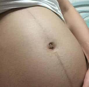 怀孕初期表现 怀孕初期有什么表现 怀孕初期这里长毛，是生男宝宝的表现？