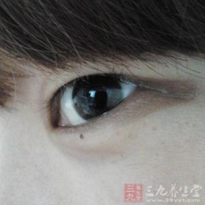 熊猫眼怎么治 熊猫眼怎么治 黑眼圈怎么治