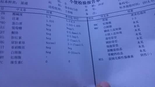 尿检前可以喝水吗 尿检之前可以喝水吗?