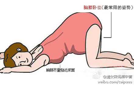 第一胎臀位可以顺产吗 胎位臀位能顺产吗