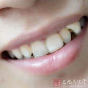 牙齿矫正常识 养生常识 矫正牙齿 给孩子矫正牙齿的最佳时间