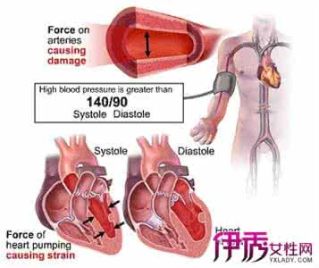 血管堵塞怎么治疗 血管堵塞的原因 秋后这部位血管易堵要注意