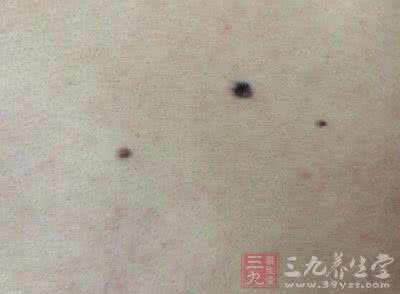 外财不富命穷人 一个黑点看出你是富命还是穷命