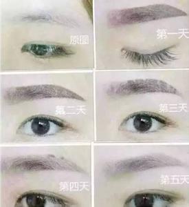 眉毛做完之后结痂扣掉 做完眉毛后要涂修复吗 眉毛涂修复液掉痂快吗?