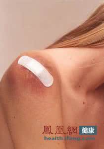 痣癌变的症状 小心这七个不疼的癌变症状(组图)