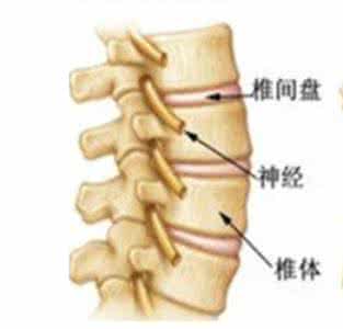 骨质增生的治疗方法 骨质增生的治疗方法 如何治疗骨质增生