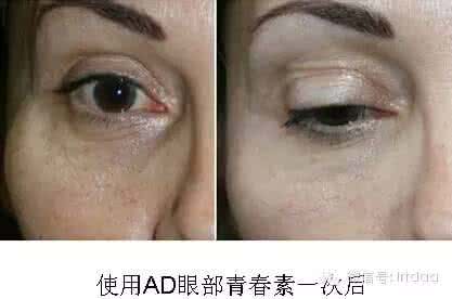 身体最爱的抗衰老食物 当心人未老眼先衰 最爱纠缠白领的4种眼部问题