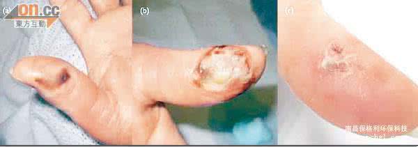 被蜈蚣咬了多久中毒 被蜈蚣咬了怎么办_蜈蚣中毒身体会产生哪些症状