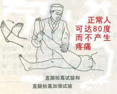 腰突引起坐骨神经痛 专家推荐：绝对秘方——治疗腰突、坐骨神经痛