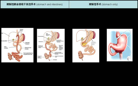 中医治疗肥胖症处方 中医治疗肥胖症处方 肥胖症的中医治疗方法