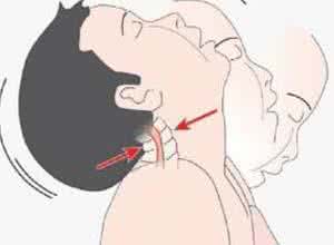 扭转痉挛 全面了解扭转痉挛的相关知识