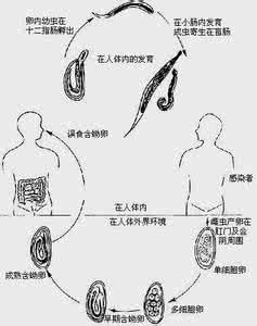 怎样知自己有没有钩虫 钩虫病