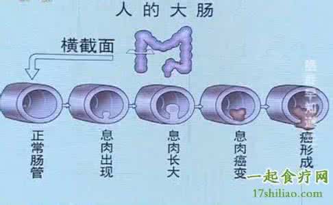 健康之路李忠 CCTV10健康之路20130731 李忠剖析情绪与癌症的关系