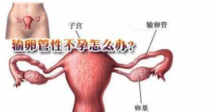 输卵管性不孕治疗 输卵管性不孕如何治疗 输卵管性不孕如何正确治疗