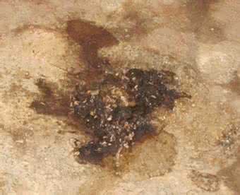 治疗大便不成形的偏方 治疗大便不成形的偏方 婴儿不大便的治疗偏方