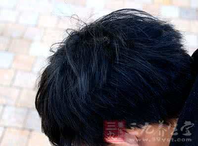 白发克星 白发克星 白发怎么办 没想到小小的种子竟是白发克星