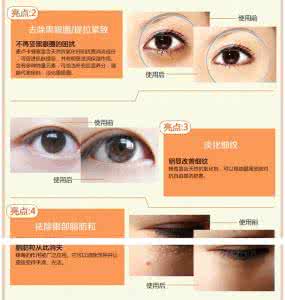 什么眼霜去眼袋效果好 去眼袋眼霜效果排名 【什么眼霜去眼袋最好】2014十大眼霜品牌排名