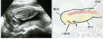 b超单看胎儿性别图 b超单看胎儿性别图 性爱姿势影响胎儿的性别