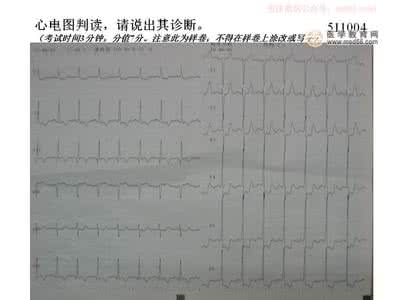 实践技能考试心电图 心电图实践技能经验总结（图解）