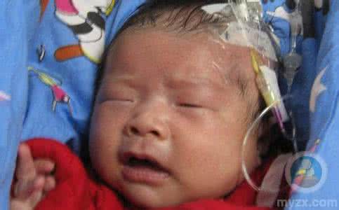 严重肺炎症状 宝宝肺炎有什么症状 肺炎严重有什么症状