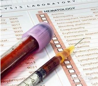 血沉高的原因 血沉高的原因 血沉高是怎么回事