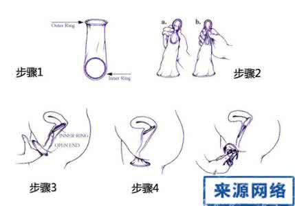 女用避孕套方法真人图 女避孕套使用方法 女用避孕套使用方法