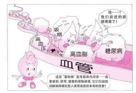 动脉硬化治疗最佳方法 防治动脉硬化，重在生活方式