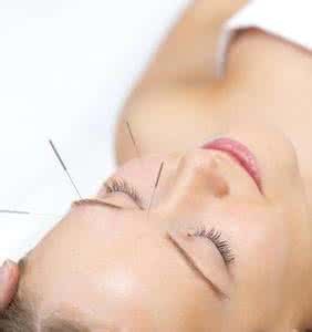 黄褐斑针灸治疗 治黄褐斑的好方法 可采用针灸治疗