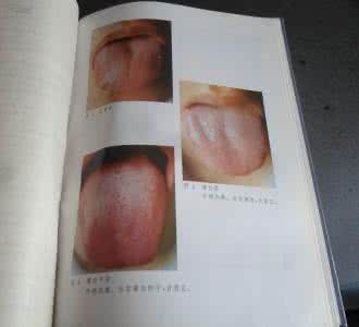 中医临床舌诊图谱 《临床舌诊图谱与疾病治疗》(翁维良)
