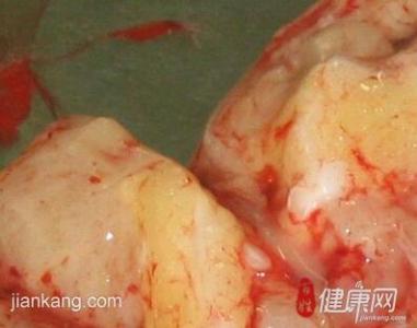 肝癌是什么原因引起的 肝癌是因为什么引起的 引起卵巢囊肿的原因是什么