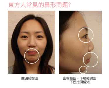 山根低鼻梁高面相 山根低鼻梁高面相 1111.面相山根的位置,面相山根算命解读人生