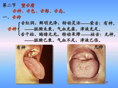 舌诊图文详解大全 舌诊系列文(八)———肝常有余,脾常不足