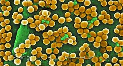 新西兰柠檬蜂蜜被检出 蜂蜜检出金黄色葡萄球菌 高温也分解不了