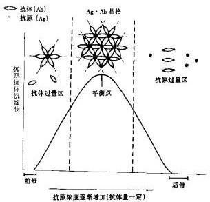 抗原抗体反应的特点 抗原抗体反应 抗原抗体反应特点
